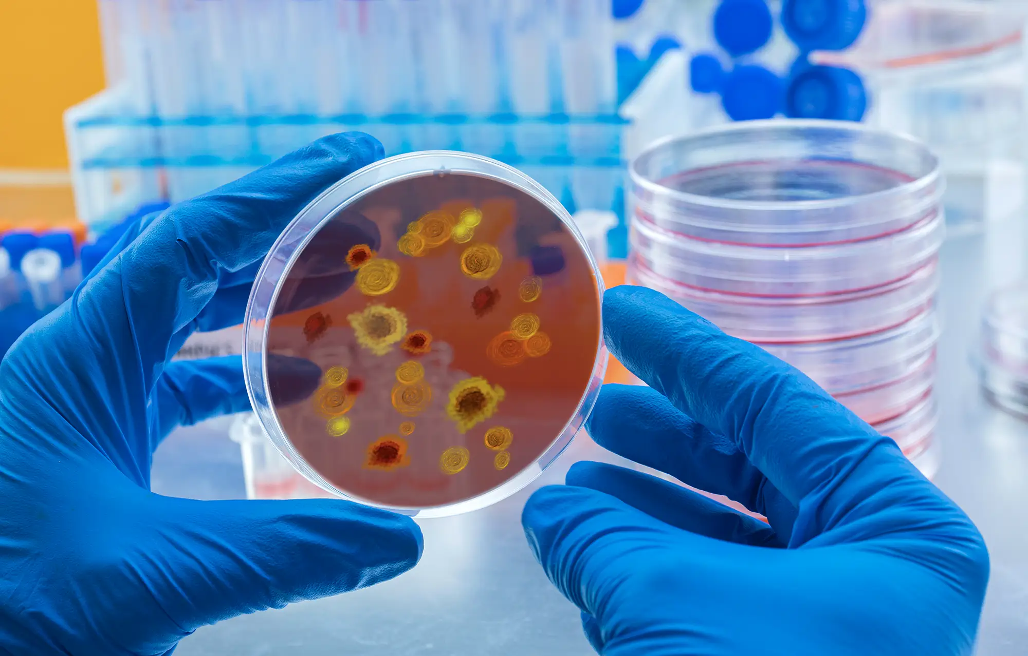 Candida – Die stille Belastung durch Hefepilze im Körper