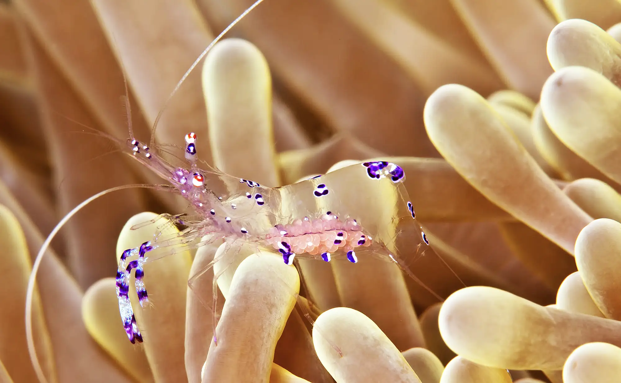 Helicobacter pylori – Wenn ein Keim die Magenschleimhaut reizt